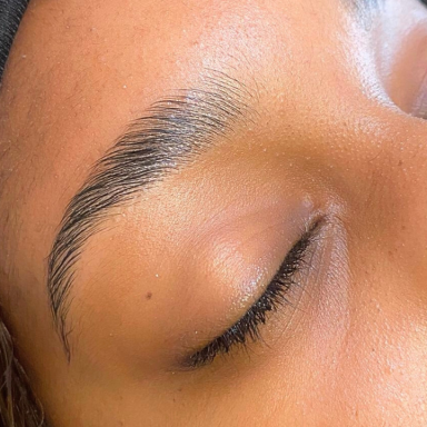 Browlift